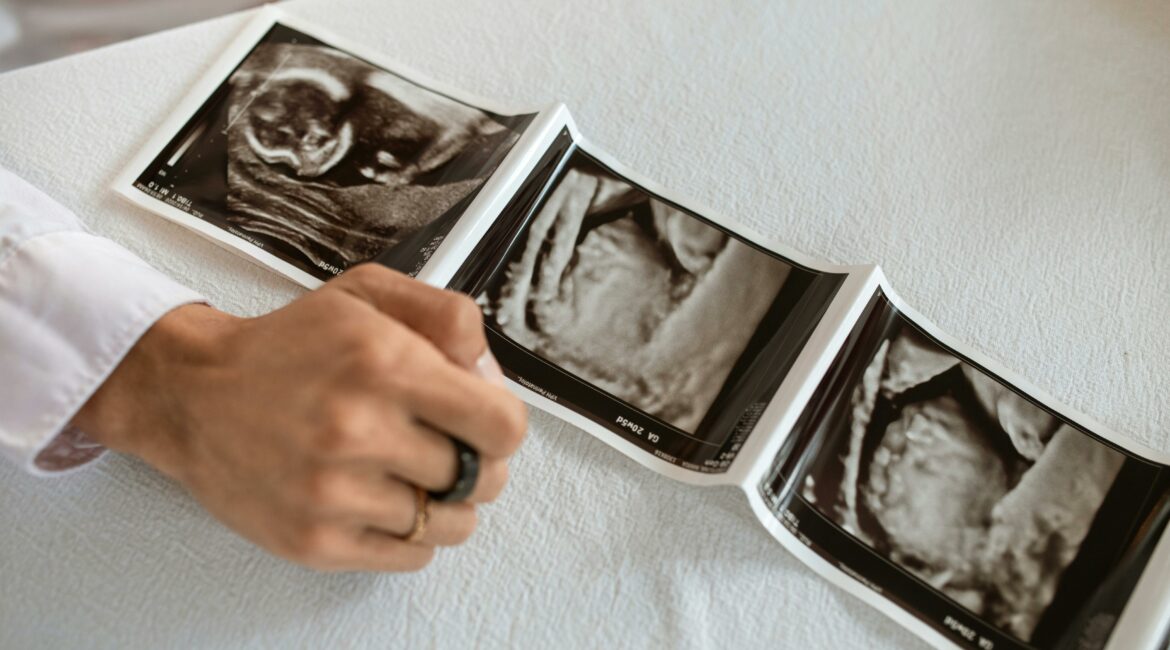 osteopaat kinderwens
